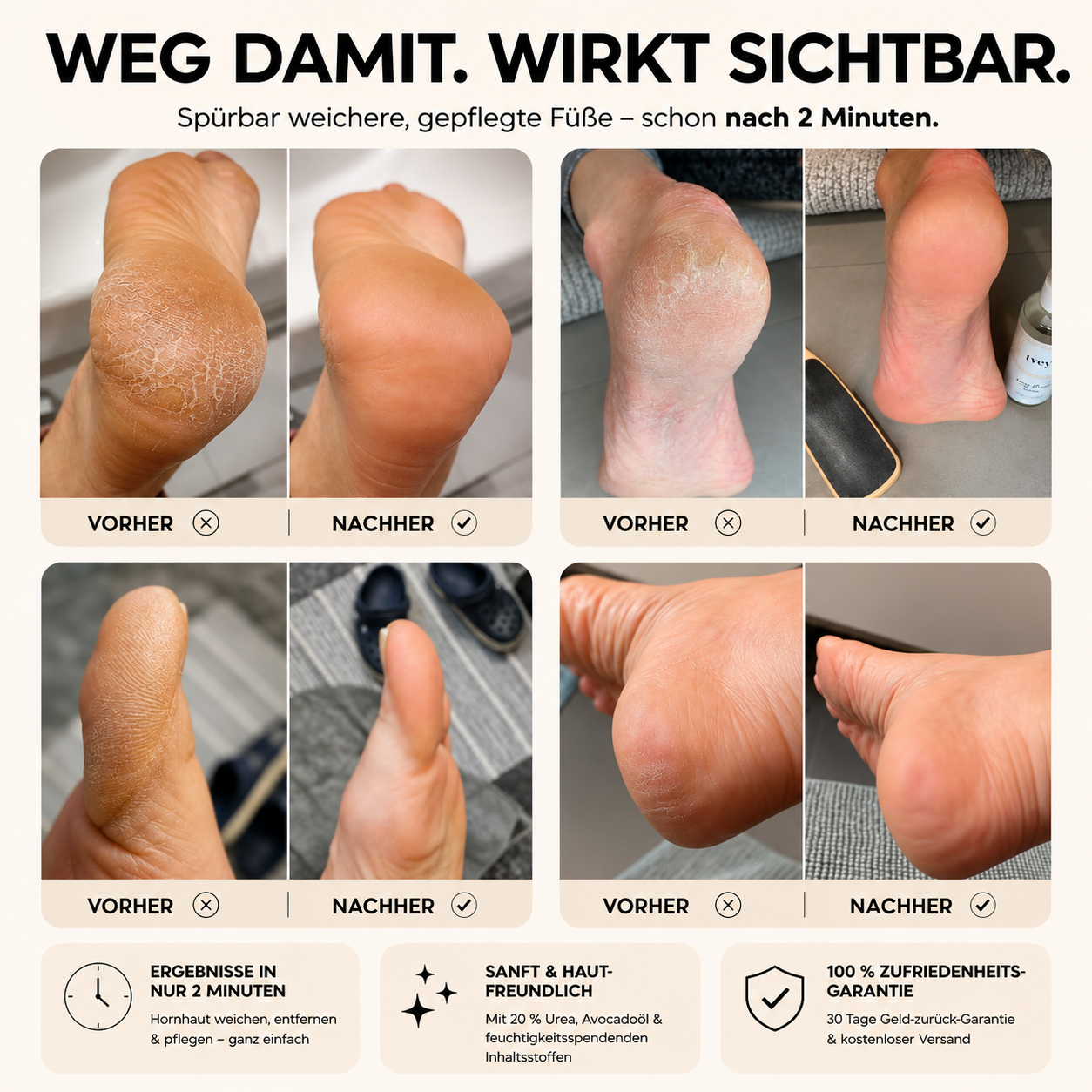Anti-Hornhaut Bundle | Endlich frei von rauer, trockener Haut.